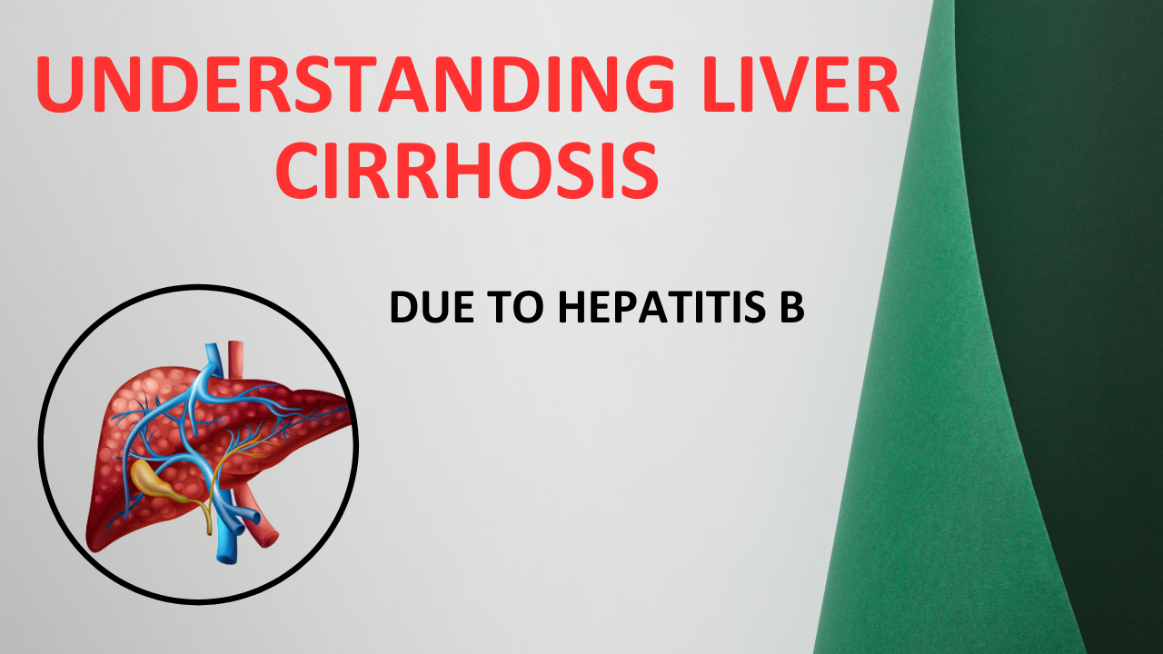 Understanding Liver Cirrhosis due to Hepatitis B